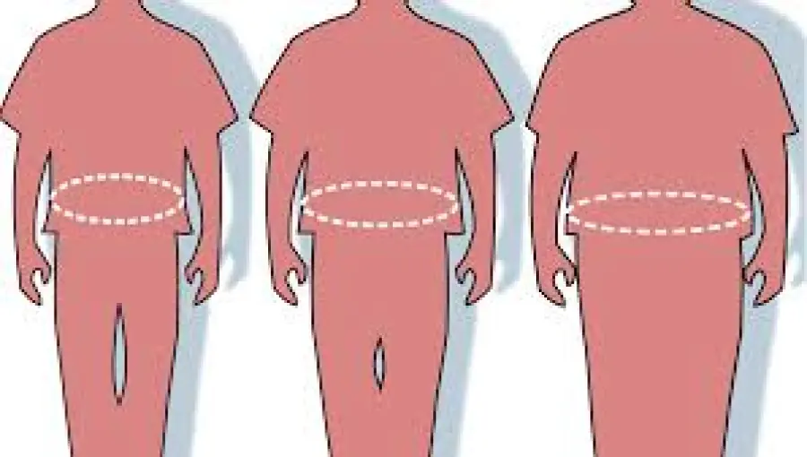 Cosa è la Chirurgia Bariatrica