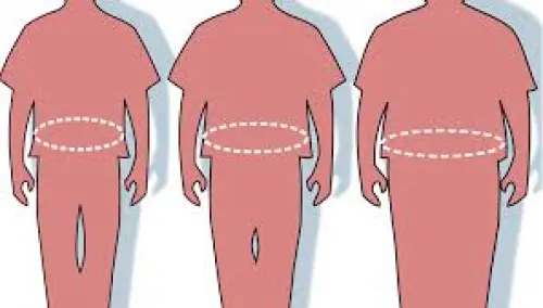 Cosa è la Chirurgia Bariatrica