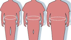 Cosa è la Chirurgia Bariatrica